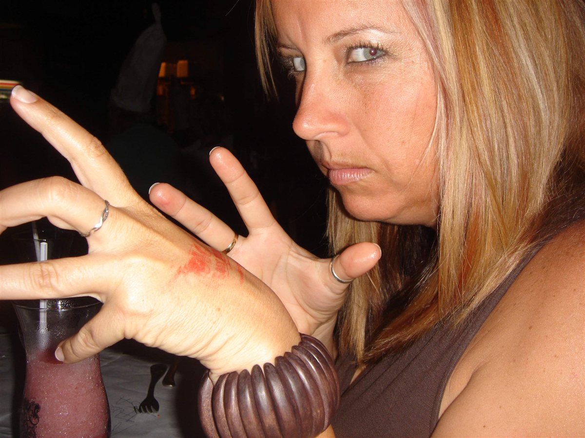 Mary inspecting her hand